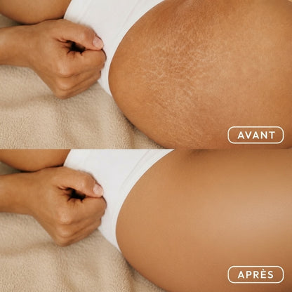 Huile corporelle précieuse Zelvyne appliquée sur la peau